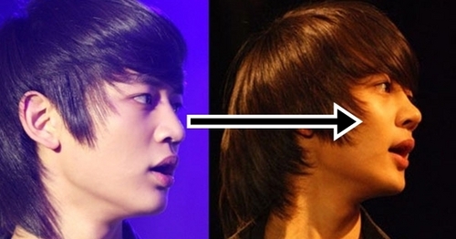 So far,it has not been confirmed but it seems like Minho had a nose job.
