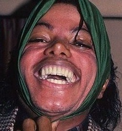  What is behind Michael Jackson's teeth?