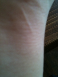  where I slit my wrist once and it was a stupid thing to do now look at the scar I am left with.