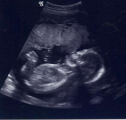  The ultrasound picture Diane gave michael of there daughter <3