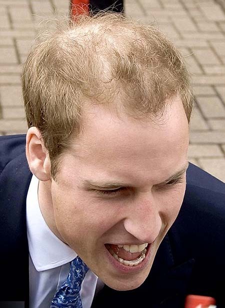 is prince william balding prince. prince-william-alding