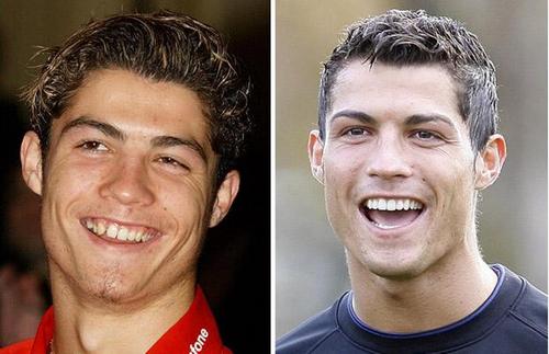  Cristiano Ronaldo had a gaps between teeth 2