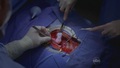 greys-anatomy - Grey's Anatomy 7x09 screencap