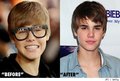 before and after - justin-bieber photo