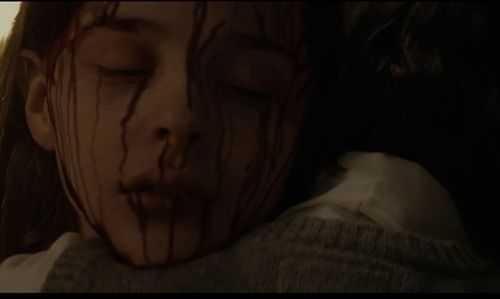  Abby's Bloody Face