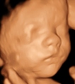 3d ultrasound 25 weeks Baby - video-sharing photo