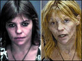 befor and after drug abuse 2 - drug-free photo