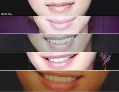  mention SHINee lips from चोटी, शीर्ष to bottom