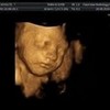 6 month ultrasound jmiles photo