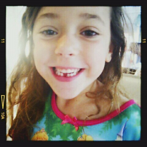  Renesmee after loossing her first tooth