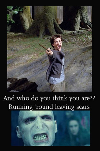  Harry Potter - Who Do anda Think anda Are...