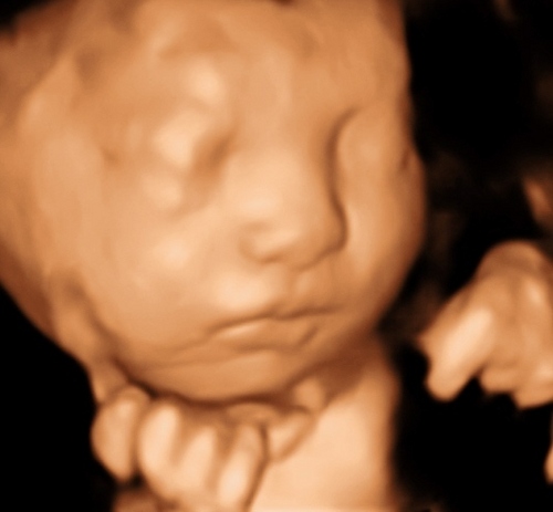  3d ultrasound 25 weeks Baby