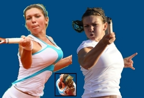  halep breast before and after