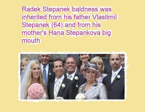  Radek Stepanek baldness was inherited from his father and from his mother's big mouth