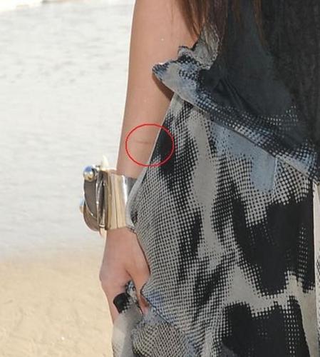  Selena has a scar/scratch