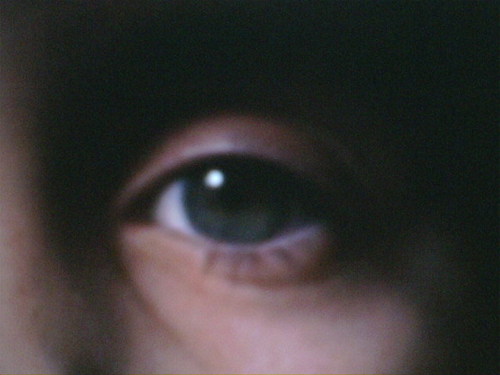 Eye 5