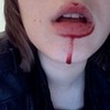 Me, without any makeup, bleeding. Made a cool picture! xXSweeneyXx photo
